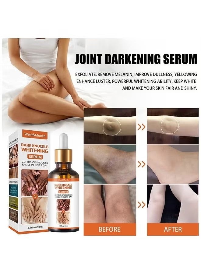 West&Month Dark knuckle Whitening Serum,7 days Treatment for Dark Spots in Hand and Feet Knuckles Exfoliating Improves Dullness Powerful Whitening Effect for Men and Women 50ml - Image 5